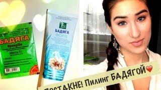 УДАЛЯЕМ ПОСТАКНЕ за 1 НЕДЕЛЮ/пилинг БАДЯГОЙ KamillaBeauty