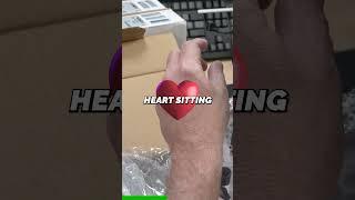 FEATURES OF CARDIOD PATTERN!