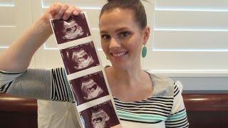 12 Week ULTRASOUND/ Pregnancy Update