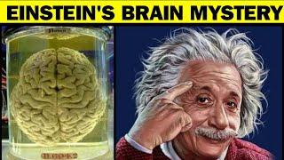 Was Einstein's Brain Different from Ours?