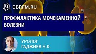 Уролог Гаджиев Н.К.: Профилактика мочекаменной болезни