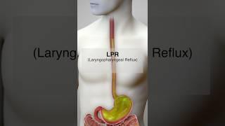 3 Types of Reflux (GERD, LPR, non-acidic LPR) #shorts @fauquierent