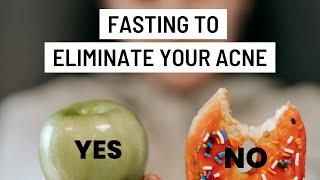 Fasting to eliminate ACNE. The acne solution Part 4
