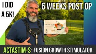 6 Weeks Post-OP From My L4/L5 TLIF Spinal Fusion Surgery and My ActaStim-S Fusion Growth Stimulator