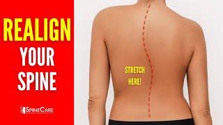 Best Exercises to Realign Your Spine