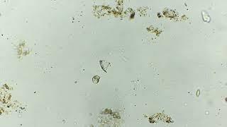Euglena - Jahlak's Microscopy
