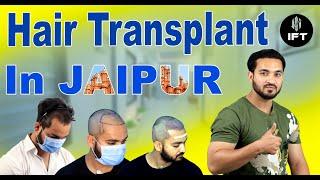 Hair Transplant in Jaipur | Cost of Hair Transplant in Jaipur | IFT Hair Science