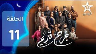 JORH KDIM EP - 11 - ﺟﺮﺡ ﻗﺪﻳﻢ