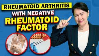 Rheumatoid Arthritis With Negative Rheumatoid Factor - is it possible?