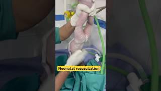 #neonatalcare #apgar #gynecologist #labourroom #viral #viralvideo #trending #fypシ゚viral #fyp #shorts