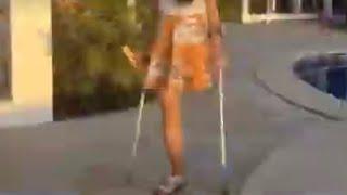 Bella & Janin(Cocostump.Com) #amputees #oneleg #amputee #crutches #devotee #disabled #amputeestrong