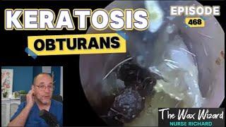 KERATOSIS OBTURANS! Episode 468