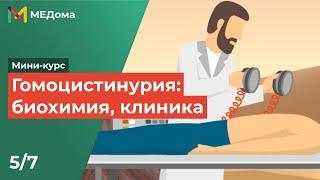 ГОМОЦИСТИНУРИЯ — причины, симптомы, патогенез, диагностика, лечение / USMLE step 1 5/7 | Медома