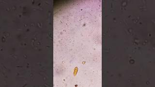 Yeast cells and Bacteria seen on stool analysis #poopsunderthemicroscope #yeastcells #fecalysis #cls