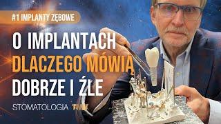 O implantach zębowych – dlaczego mówią dobrze i źle? #1 Implanty zębowe