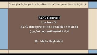 ECG course : Lecture 5 ( Practice ) ECG interpretation - حل تمارين لتخطيط القلب