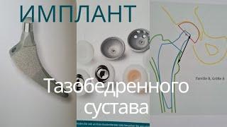 Паспорт импланта Тазобедренного сустава. Zimmer