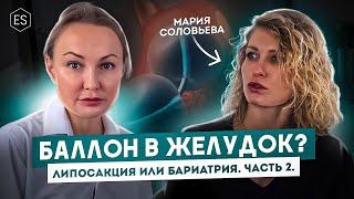  БАЛЛОН в желудок? Липосакция или бариатрия? — Мария Соловьева, бариатрический хирург. Часть 2.