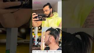 Celebrity Hair Transplant Results in India by Dr Suneet Soni at Medispa India