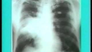 X-Ray reading (radiology) Part1