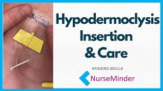 Hypodermoclysis Insertion and Care for Nurses