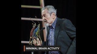 Eddie Garcia EEG shows 'minimal brain activity' – medical bulletin