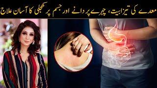 Home Remedies and Diet to Get Rid of Heat Stress - Dr Sahar Chawla