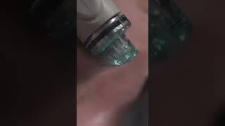 Get your HydraFacial GLOW