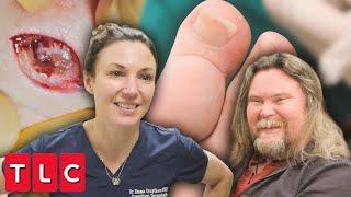 What's the Huge Lump on Tony's Big Toe? Dr. Emma Investigates | Save My Skin