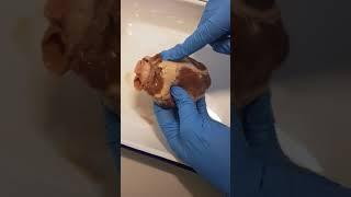 Dissection