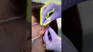 MID-HELIX PIERCING