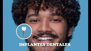 Los Implantes Dentales || Medical Toursv