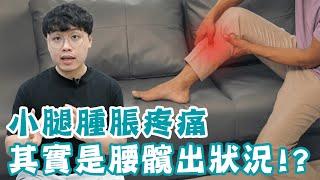 整天坐著很少走，小腿卻莫名腫脹成蘿蔔腿！？