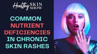 Skin Rashes & Nutrient DEFICIENCIES | Jennifer Fugo