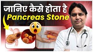 जानिए कैसे होता है Pancreas Stone ? | Ashiyana HealthCare | Dr. Deepak Kumar