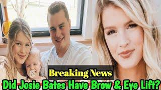Did Josie Bates Have Brow & Eye Lift? || Relating to bates