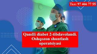 Qandli diabet 2-tipning samarali davosi. Oshqozon shuntlash operatsiyasi o'tkazildi