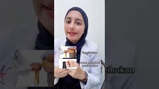 Selangkangan hitam?Ini dia solusinya! #tips #dokterkecantikan #dokterskincare #selangkanganhitam