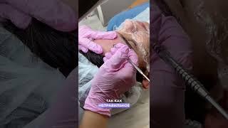 Механическая чистка лица