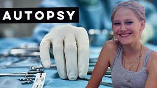 Kiely Rodni Autopsy & Toxicology!