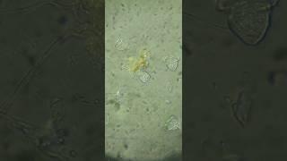 The simple life of a Vorticella. #microorganism #microscope #microbiology #rotifer #cilia