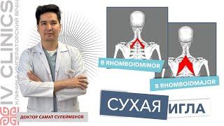 Сухая игла. RHOMBOID MAJOR. RHOMBOID MINOR. Большая и малая ромбовидные мышцы. Постановка игл.