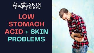 LOW Stomach Acid + Skin Problems | Jennifer Fugo