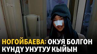 "Алты операция жасалат, окуя болгон күндү унутуу кыйын"