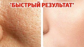 Как ИЗБАВИТЬСЯ от БОЛЬШИХ ПОР и Получить ГЛАДКУЮ КОЖУ