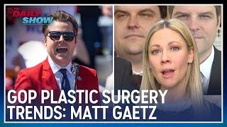 Desi Breaks Down Matt Gaetz's Plastic Surgery | The Daily Show