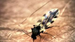 Midge bites through presenters arm - The Secret Life of Midges - BBC One