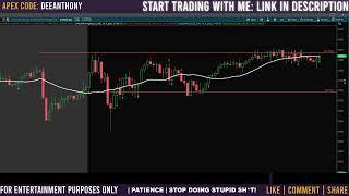 Why Staring At Charts Is Making You Lose Trades!