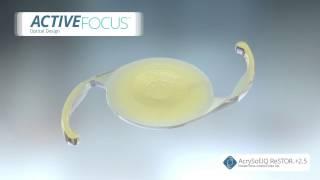 Alcon Activefocus Restor 2.5 Multifocal Intraocular Lens