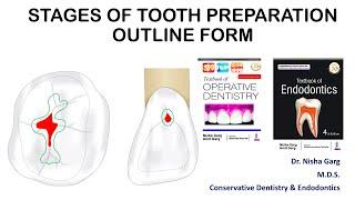 STAGES OF TOOTH PREPARATION | OUTLINE FORM | MADE EASY